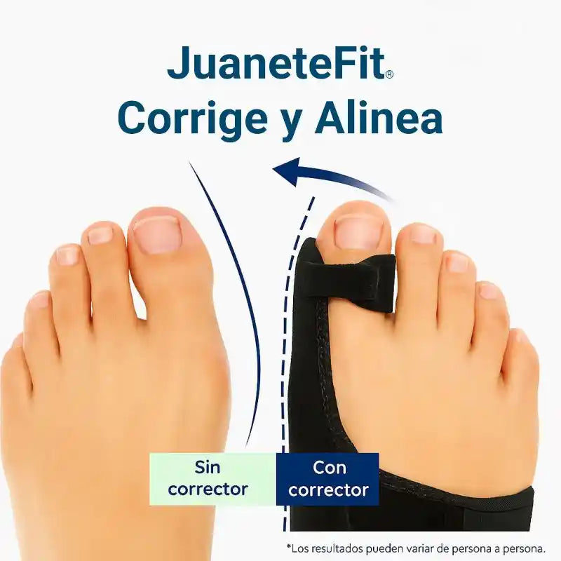 Combo JuaneteFit® – Corrección sin dolor para ambos pies