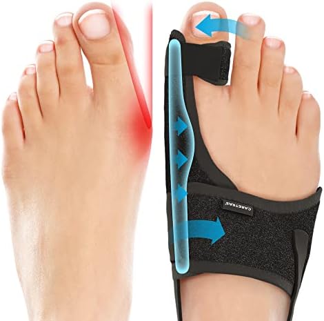 Combo JuaneteFit® – Corrección sin dolor para ambos pies